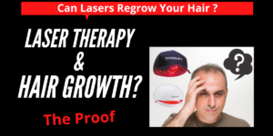 lasers-regrow-hair-review